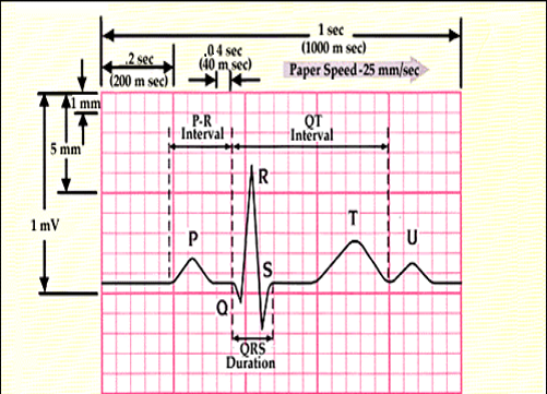 How to Read a Patient Monitor: Numbers and Lines Explained